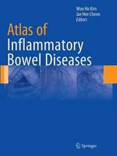 Atlas of Inflammatory Bowel Diseases