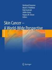 Skin Cancer - A World-Wide Perspective