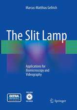 The Slit Lamp: Applications for Biomicroscopy and Videography