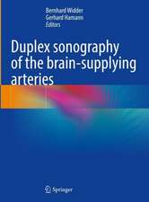 Duplex sonography of the brain-supplying arteries