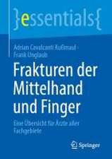 Frakturen der Mittelhand und Finger: Eine Übersicht für Ärzte aller Fachgebiete