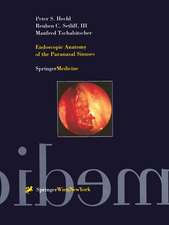 Endoscopic Anatomy of the Paranasal Sinuses