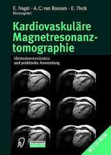 Kardiovaskulare Magnetresonanztomographie