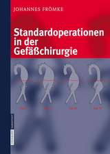 Standardoperationen in der Gefäßchirurgie