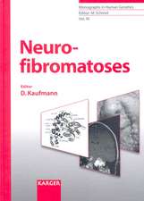 Neurofibromatoses