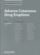 Adverse Cutaneous Drug Eruptions