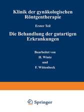 Klinik der gynäkologischen Röntgentherapie: Erster Teil: Die Behandlung der gutartigen Erkrankungen