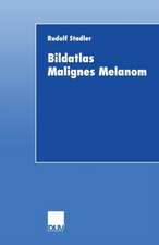 Bildatlas Malignes Melanom