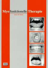 Myofunktionelle Therapie