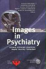 Images in Psychiatry