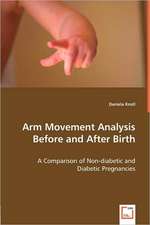 Arm Movement Analysis Before and After Birth