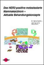 Das HER2-positive metastasierte Mammakarzinom - Aktuelle Behandlungskonzepte