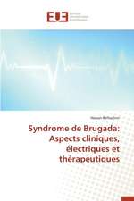 Syndrome de Brugada: Aspects Cliniques, Electriques Et Therapeutiques