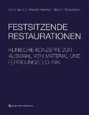 Festsitzende Restaurationen