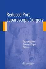 Reduced Port Laparoscopic Surgery