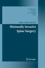 State of the Art for Minimally Invasive Spine Surgery