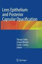 Lens Epithelium and Posterior Capsular Opacification