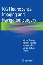 ICG Fluorescence Imaging and Navigation Surgery