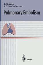 Pulmonary Embolism