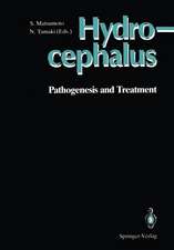 Hydrocephalus: Pathogenesis and Treatment