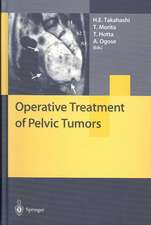 Operative Treatment of Pelvic Tumors