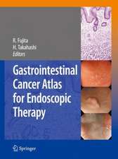 Gastrointestinal Cancer Atlas for Endoscopic Therapy