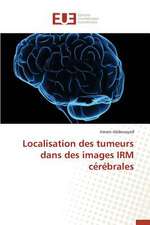 Localisation Des Tumeurs Dans Des Images Irm Cerebrales: Un Nouveau Protocole de Securite