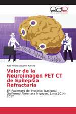 Valor de la Neuroimagen PET CT de Epilepsia Refractaria