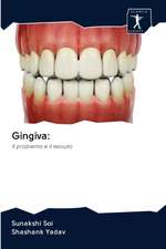 Gingiva: