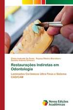 Restaurações Indiretas em Odontologia