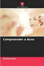 Compreender a Acne