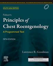 Felson's Principles of Chest Roentgenology, A Programmed Text, 5 Edition: South Asia Edition: A Programmed Text