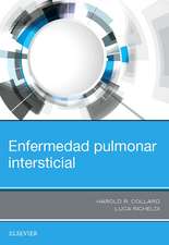 Enfermedad pulmonar intersticial