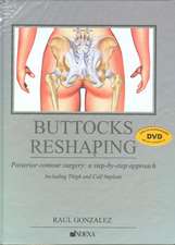 Buttocks Reshaping