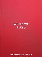 While We Bleed