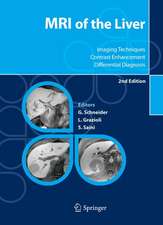 MRI of the Liver: Imaging Techniques, Contrast Enhancement, Differential Diagnosis