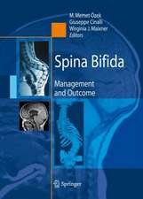 Spina Bifida: Management and Outcome