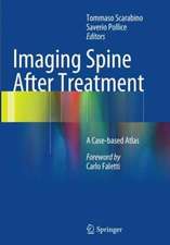 Imaging Spine After Treatment