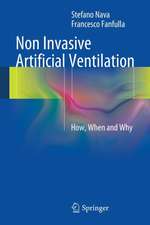 Non Invasive Artificial Ventilation: How, When and Why