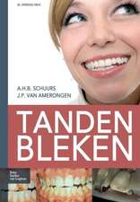 Tanden Bleken