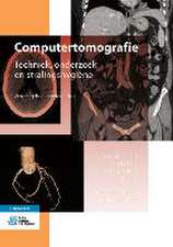 Computertomografie