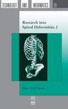 Research Into Spinal Deformities 2