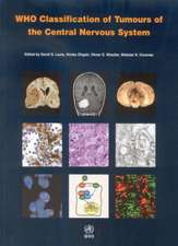 Who Classification of Tumours of the Central Nervous System