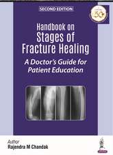 Handbook on Stages of Fracture Healing: A Doctor's Guide for Patient Education