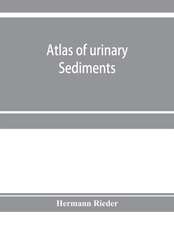 Atlas of urinary sediments; with special reference to their clinical significance