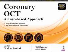 Coronary OCT