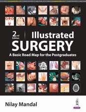 Illustrated Surgery: A Basic Road Map for Postgraduates