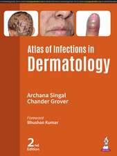 Atlas of Infections in Dermatology