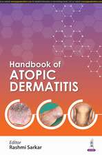 Handbook of Atopic Dermatitis