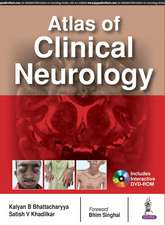 Atlas of Clinical Neurology